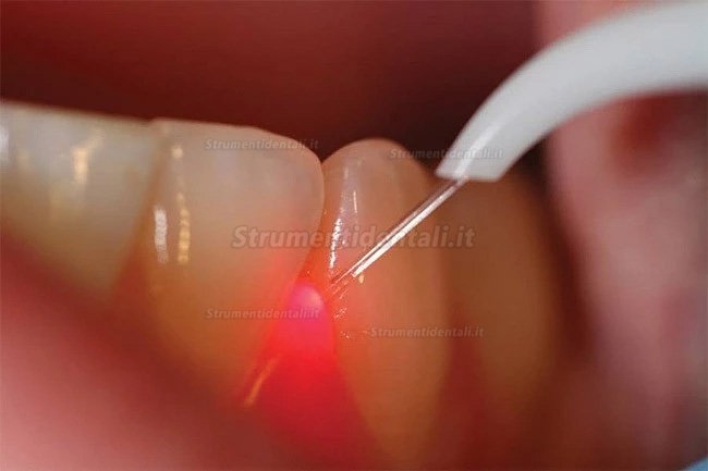 Gigaa Laser CHEESE Link Mini laser a diodi dentali 7W-10W 810/980nm